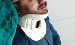 سانحه با موتور سیکلت و مصدومیت شدید معلم عشایری لالی در مسیر مدرسه