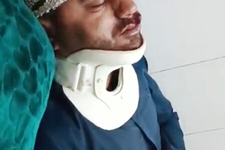 سانحه با موتور سیکلت  و مصدومیت شدید معلم عشایری لالی  در مسیر مدرسه