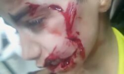 امیرعلی قاسمی قاسموند ؛ قربانی سهلانگاری نهادهای مسئول